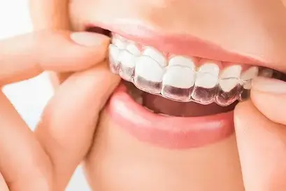 Invisalign