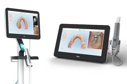 Itero Digital Scanner