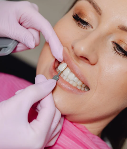 Dentist comparing tooth shades with a patient's natural teeth during a dental consultation